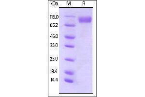 Biotinylated Human CD200 R1, Fc,Avitag on  under reducing (R) condition. (CD200R1 Protein (AA 27-266) (Fc Tag,AVI tag,Biotin))