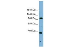Image no. 1 for anti-Excision Repair Cross-Complementing Rodent Repair Deficiency, Complementation Group 4 (ERCC4) (AA 431-480) antibody (ABIN6742132)