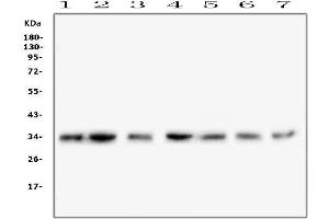 Western blot analysis of COPE using anti-COPE antibody (ABIN7602509).