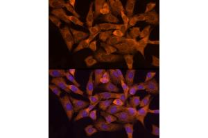 Immunofluorescence analysis of NIH/3T3 cells using N Rabbit mAb (ABIN7268773) at dilution of 1:200 (40x lens). (NAT1 抗体)