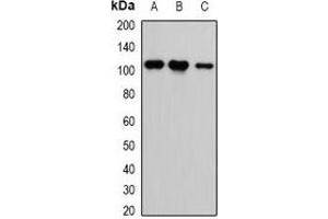 Western blot analysis of CASK expression in HEK293T (A), H460 (B), A549 (C) whole cell lysates.