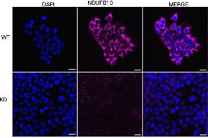 anti-NADH Dehydrogenase (Ubiquinone) 1 beta Subcomplex, 10, 22kDa (NDUFB10) antibody