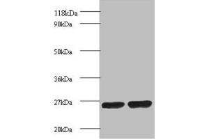 Western blot All lanes: Proteasome subunit beta 1 antibody at 2 μg/mL Lane 1: EC109 whole cell lysate Lane 2: 293T whole cell lysate Secondary Goat polyclonal to rabbit IgG at 1/15000 dilution Predicted band size: 27 kDa Observed band size: 27 kDa