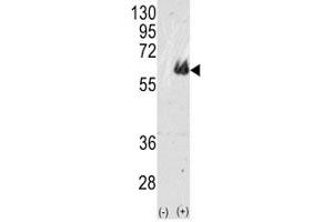 Western Blotting (WB) image for anti-tau Protein (AA 677-707) antibody (ABIN3031796)