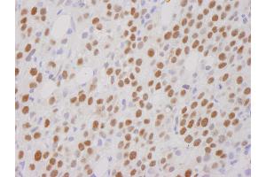 Immunohistochemistry (IHC) image for anti-REST Corepressor 1 (RCOR1) (C-Term) antibody (ABIN7448481) (CoREST 抗体  (C-Term))