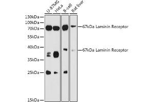 RPSA/Laminin Receptor Antikörper  (AA 1-295)