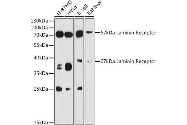 RPSA/Laminin Receptor antibody  (AA 1-295)