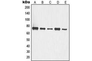 Western blot analysis of p63 expression in A549 (A), HCT116 (B), COLO205 (C), LOVO (D), HT29 (E) whole cell lysates. (TCP1 alpha/CCTA 抗体  (C-Term))