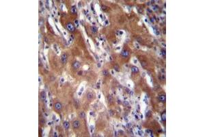 Immunohistochemistry analysis in formalin fixed and paraffin embedded human liver tissue reacted with GNE / GLCNE Antibody (N-term) followed by peroxidase conjugation of the secondary antibody and DAB staining. (GNE 抗体  (N-Term))