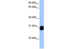 IGFBP7 antibody used at 1 ug/ml to detect target protein. (IGFBP7 抗体  (C-Term))