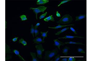 Immunofluorescence of monoclonal antibody to UMPS on HeLa cell. (UMPS 抗体  (AA 381-479))