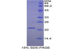 SDS-PAGE (SDS) image for Inter alpha Globulin Inhibitor H5 (ITIH5) (AA 569-737) protein (His tag) (ABIN1877516)
