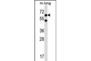 Mouse Nlk Antibody (C-term) (ABIN657850 and ABIN2846811) western blot analysis in mouse lung tissue lysates (35 μg/lane). (Nemo-Like Kinase 抗体  (C-Term))