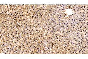 Detection of FABP1 in Rat Liver Tissue using Polyclonal Antibody to Fatty Acid Binding Protein 1 (FABP1) (FABP1 抗体  (AA 2-127))