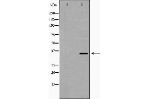 Western blot analysis of extracts of Jurkat , using PPP2CB antibody. (PPP2CB 抗体  (C-Term))