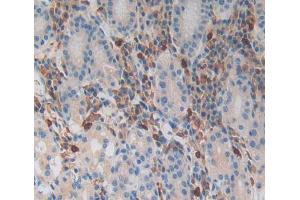 IHC-P analysis of Kidney tissue, with DAB staining. (MGA 抗体  (AA 2450-2733))