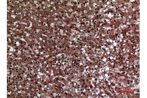 Immunohistochemistry (IHC) analysis of paraffin-embedded Human Liver, antibody was diluted at 1:100. (F11R 抗体  (Internal Region))