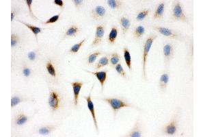 Immunohistochemistry (IHC) image for anti-Wiskott-Aldrich Syndrome (Eczema-thrombocytopenia) (WAS) (AA 129-156), (C-Term) antibody (ABIN3043961)