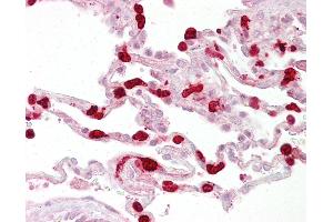 Anti-GSTT1 antibody IHC of human lung. (GSTT1 抗体  (C-Term))