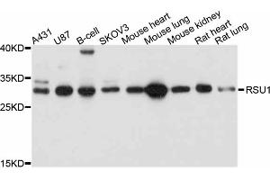 Western blot analysis of extracts of various cell lines, using RSU1 antibody (ABIN4905071) at 1:1000 dilution. (RSU1 抗体)