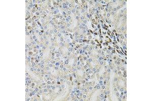 Immunohistochemistry of paraffin-embedded rat kidney using PSMC3 Antibody (ABIN3022704, ABIN3022705, ABIN3022706 and ABIN6219146) at dilution of 1:100 (40x lens). (PSMC3 抗体  (AA 1-180))