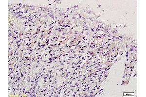 Immunohistochemistry (IHC) image for anti-EGFR vIII (EGFRv3) (AA 1-50) antibody (ABIN742035) (EGFRviii 抗体  (AA 1-50))