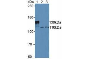 Western blot analysis of (1) Mouse Serum, (2) Human Jurkat Cells and (3) Human HeLa cells. (SIRT1 抗体  (AA 236-490))