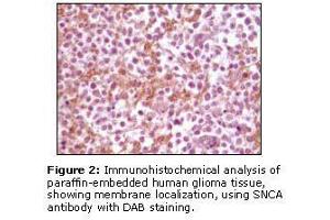 Image no. 1 for anti-Synuclein, alpha (SNCA) antibody (ABIN232104) (SNCA 抗体)