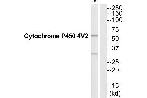 Western blot analysis of extracts from Jurkat cells, using CYP4V2 antibody.