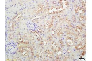 Formalin-fixed and paraffin embedded rat kidney labeled with Rabbit Anti PLEKHM2/SKIP Polyclonal Antibody, Unconjugated (ABIN872446) at 1:200 followed by conjugation to the secondary antibody and DAB staining (PLEKHM2 抗体  (AA 688-750))
