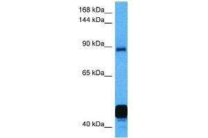 Western Blotting (WB) image for anti-Nuclear Factor of Activated T-Cells, Cytoplasmic, Calcineurin-Dependent 2 (NFAT1) (C-Term) antibody (ABIN2780879)