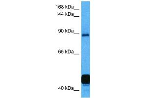 Host:  Mouse  Target Name:  NFATC2  Sample Tissue:  Mouse Kidney  Antibody Dilution:  1ug/ml (NFAT1 抗体  (C-Term))