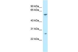 WB Suggested Anti-TTC39B Antibody Titration: 1. (TTC39B 抗体  (C-Term))