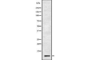 Western blot analysis of GNG10 expression in HepG2 cell lysate,The lane on the left is treated with the antigen-specific peptide. (GNG10 抗体  (Internal Region))