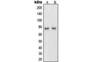 Western blot analysis of Netrin 1 expression in rat brain (A), PC12 (B) whole cell lysates. (Netrin 1 抗体  (C-Term))
