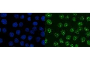 IF analysis of XRCC1 using anti-XRCC1 antibody (ABIN7601989).
