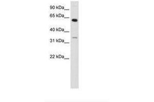 Image no. 1 for anti-Zinc Finger Protein 609 (ZNF609) (AA 71-120) antibody (ABIN202985) (ZNF609 抗体  (AA 71-120))