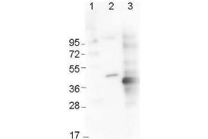 Western Blot using  Immunochemicals' Mouse Anti-6x-His Epitope Tag Monoclonal Antibody showing detection of the 6xHis sequence on N-terminally-tagged (lane 2) and C-terminally-tagged recombinant proteins (lane 3). (His Tag 抗体)