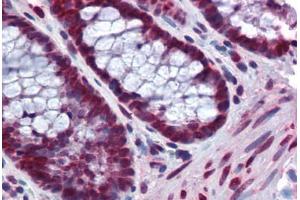 Human Colon: Formalin-Fixed, Paraffin-Embedded (FFPE) (BANF1 抗体  (AA 1-90))