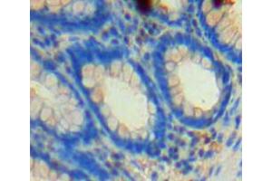 Used in DAB staining on fromalin fixed paraffin-embedded rectum tissue