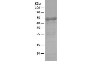 Western Blotting (WB) image for Protein Kinase, AMP-Activated, alpha 1 Catalytic Subunit (PRKAA1) (AA 349-559) protein (His-IF2DI Tag) (ABIN7124656)