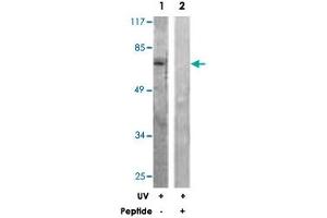 Western blot analysis of extracts from HeLa cells, treated with UV (5 mins), using RAF1 polyclonal antibody . (RAF1 抗体)