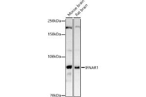 Western blot analysis of extracts of various cell lines, using IFN antibody (ABIN3015552, ABIN3015553, ABIN1680393 and ABIN6218813) at 1:1000 dilution. (IFNAR1 抗体  (AA 28-290))