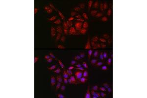 Immunofluorescence analysis of U2OS cells using RB Rabbit pAb (ABIN7269795) at dilution of 1:150 (40x lens). (RAB11B 抗体  (AA 130-215))