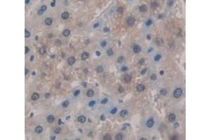 Used in DAB staining on fromalin fixed paraffin- embedded Kidney tissue (KNG1 抗体  (AA 367-430))