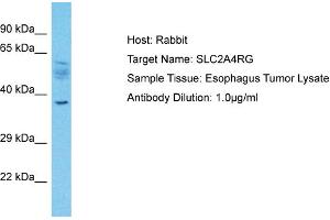 Host: Rabbit Target Name: SLC2A4RG Sample Type: Esophagus Tumor lysates Antibody Dilution: 1. (SLC2A4RG 抗体  (N-Term))