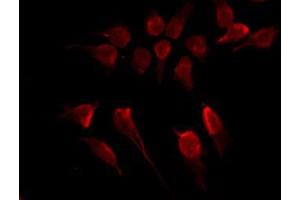 Immunofluorescence (fixed cells) (IF/ICC) image for anti-Inhibitor of kappa Light Polypeptide Gene Enhancer in B-Cells, Kinase beta (IKBKB) (pTyr188) antibody (ABIN6256660)