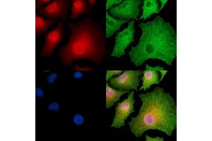 ABIN6262437 and ABIN6278874 staining  cells by IF/ICC. (CARD18 抗体  (C-Term))