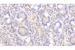 Immunohistochemistry (IHC) image for anti-Glutathione S-Transferase alpha 4 (GSTA4) (AA 3-222) antibody (ABIN7432334)