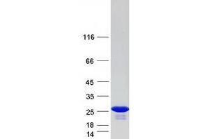 Western Blotting (WB) image for Heat Shock 27kDa Protein 2 (HSPB2) protein (Myc-DYKDDDDK Tag) (ABIN2723113)
